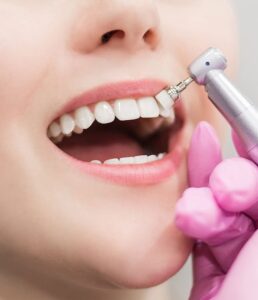 Estética Dental
