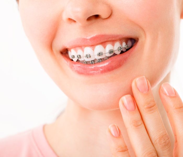 Uso de la ortodoncia correctiva